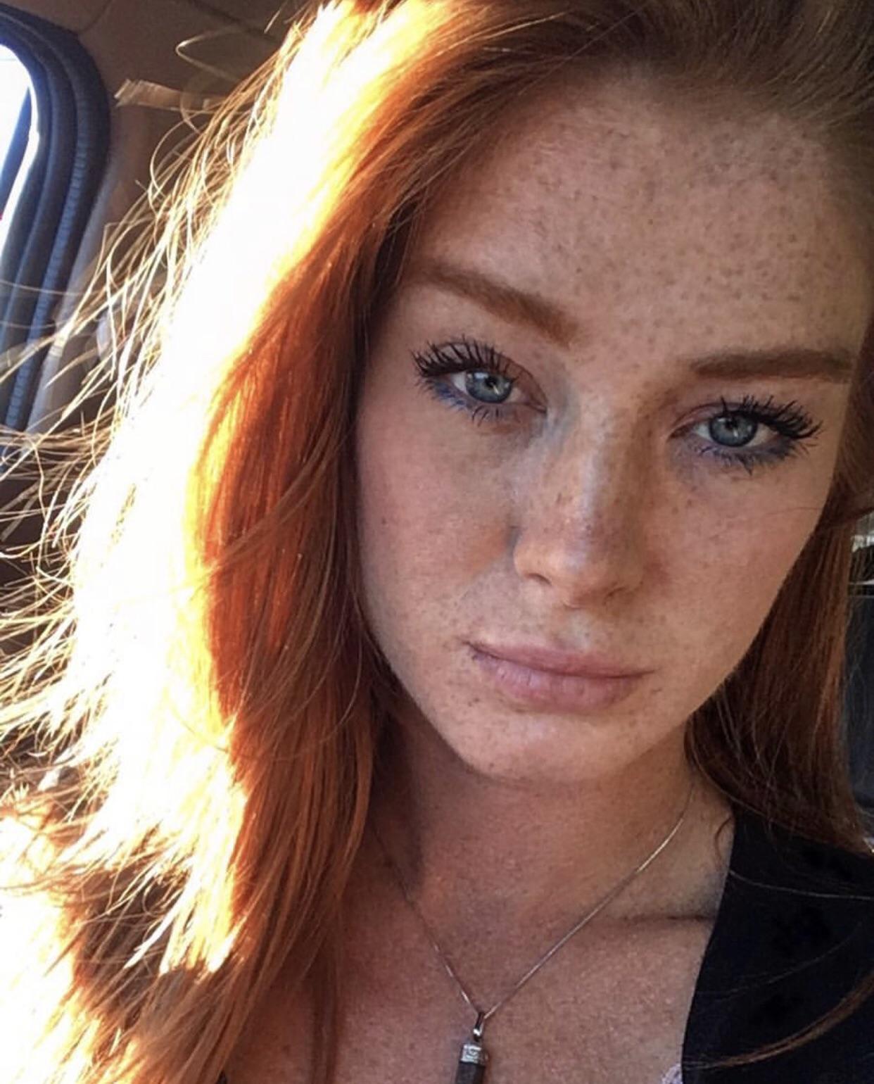 Hot Girl With Freckles